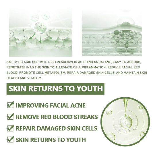 Sérum Facial Anti-Acne